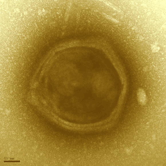 發(fā)現(xiàn)新的巨型病毒群